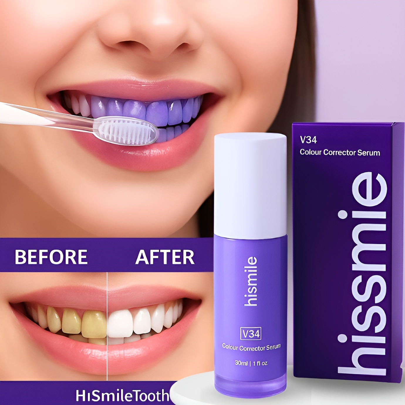 Hismile V34 Instant Teeth Whitening